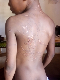 Centrafrique : Une fillette de 9 ans, victime de maltraitance au quartier Kokoro 3 dans le 3ème arrondissement